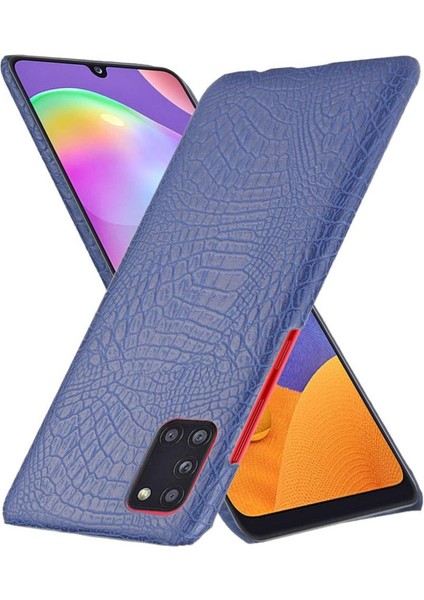 Samsung Galaxy Stylish Klasik Timsah Moda Anti Için Şık Klasik Kılıf (Yurt Dışından) modelleri