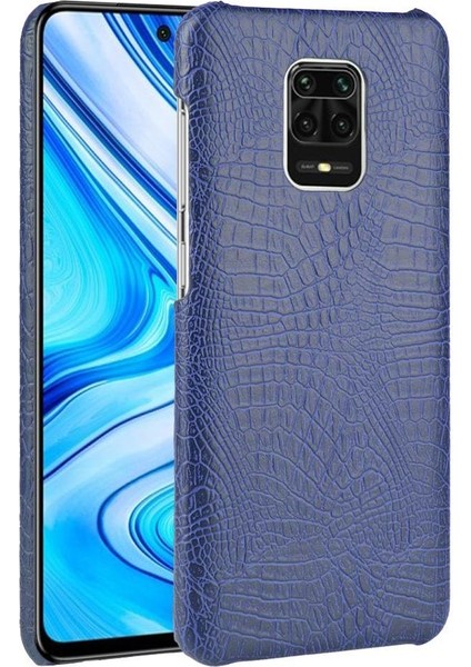Xiaomi Redmi Not 9 Pro/ Pro Max Anti Scratch Için Şık Klasik Durumda (Yurt Dışından)