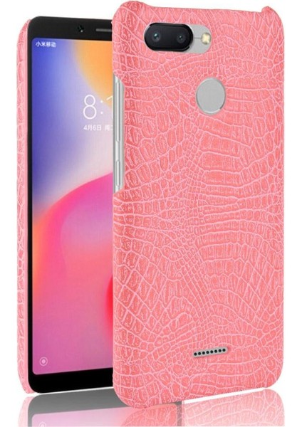 Xiaomi Redmi 6 Anti Scratch Koruyucu Kapak Için Şık Klasik Durumda (Yurt Dışından)