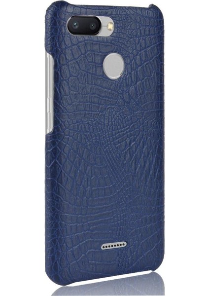 Xiaomi Redmi 6 Anti Scratch Koruyucu Kapak Için Şık Klasik Durumda (Yurt Dışından)