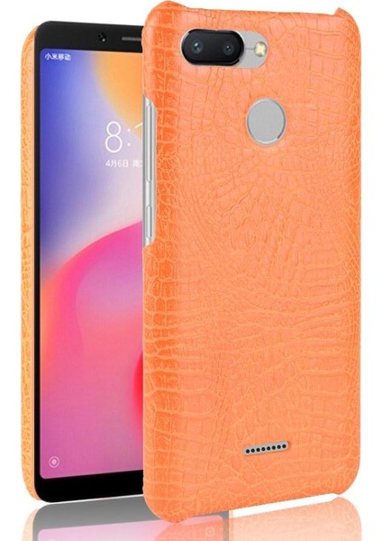 Xiaomi Redmi 6 Anti Scratch Koruyucu Kapak Için Şık Klasik Durumda (Yurt Dışından)