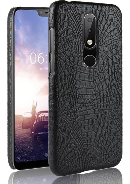 Nokia 5.1 Plus /nokia X5 Classic Timsah Anti Için Şık Klasik Kılıf (Yurt Dışından)