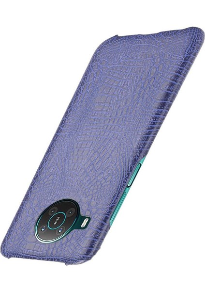 Nokia X10/X20 Klasik Timsah Moda Anti Için Şık Klasik Kılıf (Yurt Dışından) modelleri