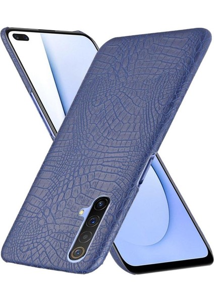 Realme X3 Koruyucu Kapak Için Şık Klasik Kılıf Klasik Timsah Anti (Yurt Dışından)