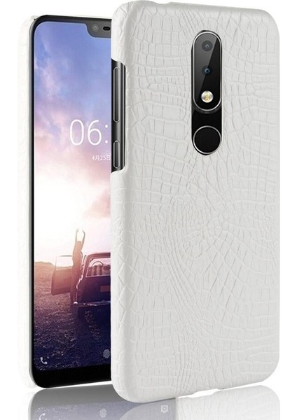 Nokia 5.1 Plus /nokia X5 Classic Timsah Anti Için Şık Klasik Kılıf (Yurt Dışından)