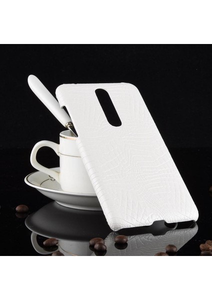 Nokia 3.1 Plus Anti Scratch Klasik Timsah Için Şık Klasik Kılıf (Yurt Dışından)