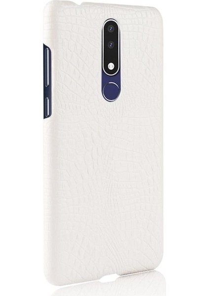 Nokia 3.1 Plus Anti Scratch Klasik Timsah Için Şık Klasik Kılıf (Yurt Dışından)