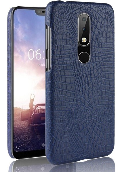 Nokia 5.1 Plus /nokia X5 Classic Timsah Anti Için Şık Klasik Kılıf (Yurt Dışından)