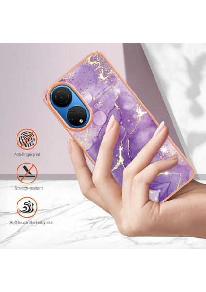 Onur X7 Için Durum (Yurt Dışından) modelleri