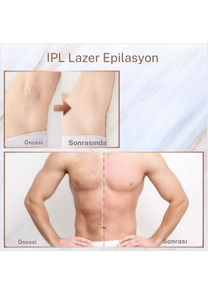 Trend Farma Hediyeli Soğuk Buz Ipl Lazer Epilasyon Cihazı - 999.999 Atım, Ağrısız Buz Lazer