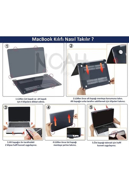 Macbook Pro (M1-M2) Kılıf 14.2 Inç A2442-A2779-A2992 A2918 2020/2022 Şeffaf Sert Kapak Koruma Macup-19 Orman Yeşil