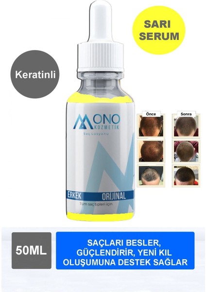 2 Adet Sarı Saç Sakal, Bıyık, Kaş Bakım Serumu - Saç Çıkarmaya Yardımcı ve Saç Yoğunluğunu Artırır,