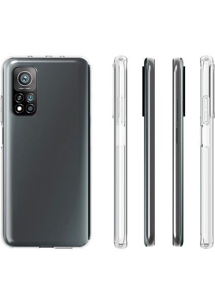 Xiaomi Redmi K30S Için 10 Adet/paket Filigrana Dayanıklı Yumuşak Tpu Kılıf (Yurt Dışından) modelleri