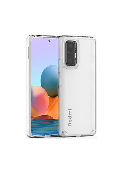 Redmi Note 10 Pro Kılıf Tam Koruma Sağlayan Sert Avila Premium Şeffaf Tank Kapak