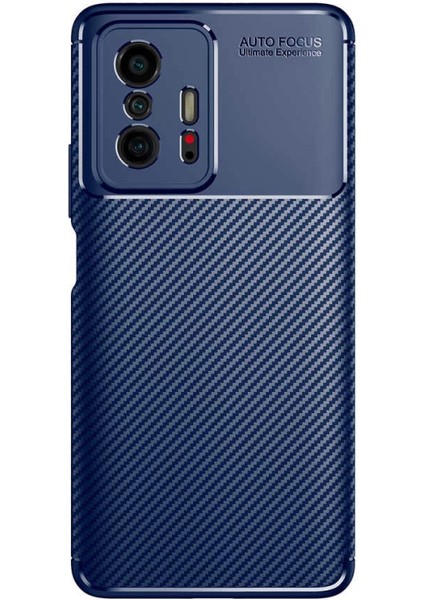 Xiaomi Mi 11T 5g Kılıf Zore Negro Silikon Kapak