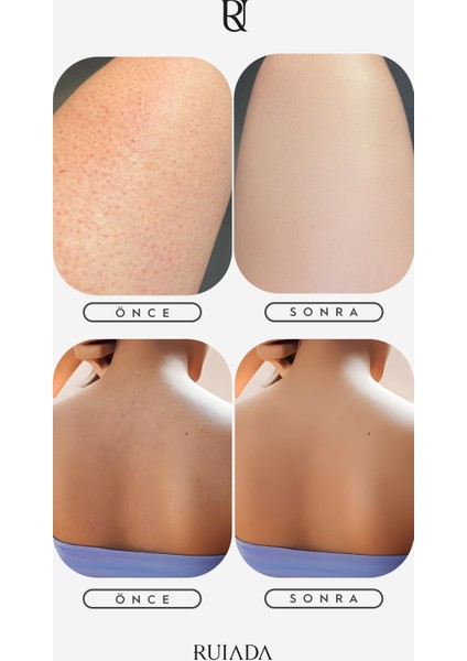 Flowers Series +50 Factor %100 Floş ipek İnce Banyo Duş Kesesi Peeling Eldiveni (BUTTERFLY) fırsatları