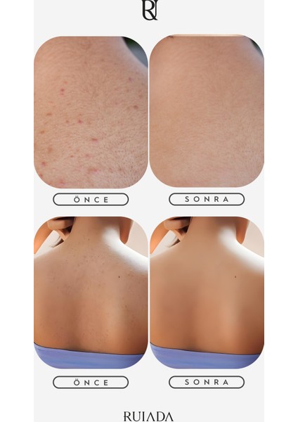 +80 Factor Siyah Sırt Banyo Duş Kesesi %100 Floş İpek Peeling indirimleri
