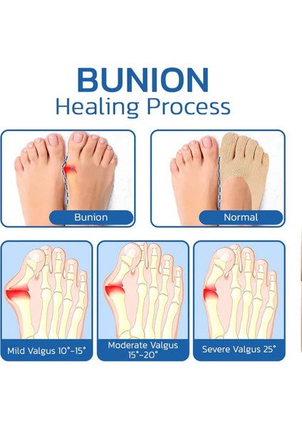 5 Çift Tarzı Kadın Ortopedik Sıkıştırma Parmak Arası Çorapları, Jel Sekmesi ile Tam Parmak Yoga Çorabı, Yumuşak Nefes Alan Beş Parmak Çoraplar (Yurt Dışından) indirimleri