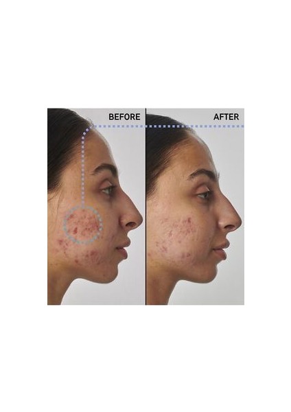 Scar, Mark And Wrinkle Solution With 1% Retinol - Yüz Serumu 30 ml
