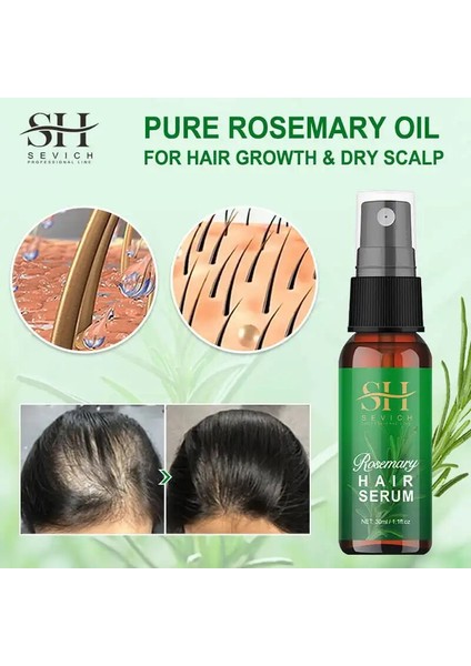 Biberiye Serumu Saç Büyümesini Durdurmak Saç Dökülmesini Hızlı Büyüyen Saç Temel Sprey Güzellik Saç Bakımı Kuru Saç Derisi Ferahlatıcı Sprey (Yurt Dışından)