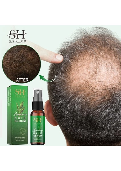 Biberiye Serumu Saç Büyümesini Durdurmak Saç Dökülmesini Hızlı Büyüyen Saç Temel Sprey Güzellik Saç Bakımı Kuru Saç Derisi Ferahlatıcı Sprey (Yurt Dışından) fiyatları