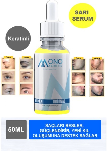 Sarı Saç Bakım Yağı - ve Saç Yoğunluğunu , Saçı Besler , Keratin