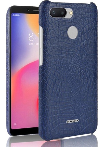 Xiaomi Redmi 6 Anti Scratch Koruyucu Kapak Için Şık Klasik Durumda (Yurt Dışından)