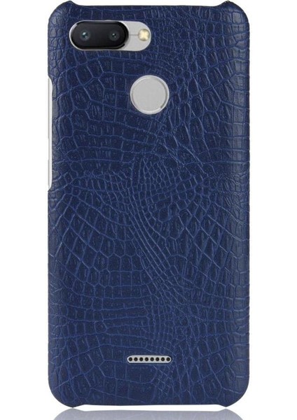 Xiaomi Redmi 6 Anti Scratch Koruyucu Kapak Için Şık Klasik Durumda (Yurt Dışından)