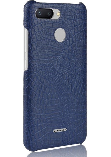 Xiaomi Redmi 6 Anti Scratch Koruyucu Kapak Için Şık Klasik Durumda (Yurt Dışından)