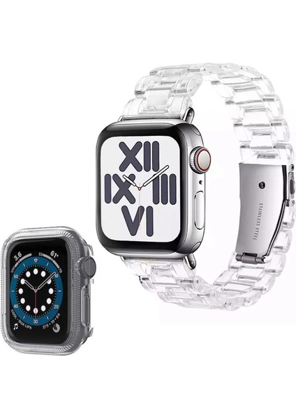 Apple Watch Seri 44/42 mm Uyumlu Kasa Korumalı Kordon