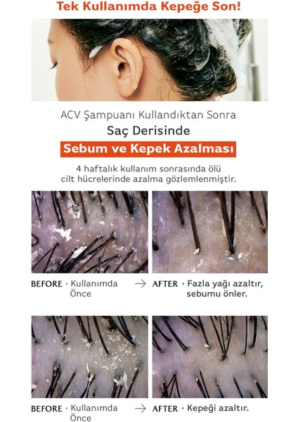 Saç Derisini Canlandıran ve Parlaklaştıran Sirke Özlü Şampuan Lador Acv Vinegar Shampoo 430ML