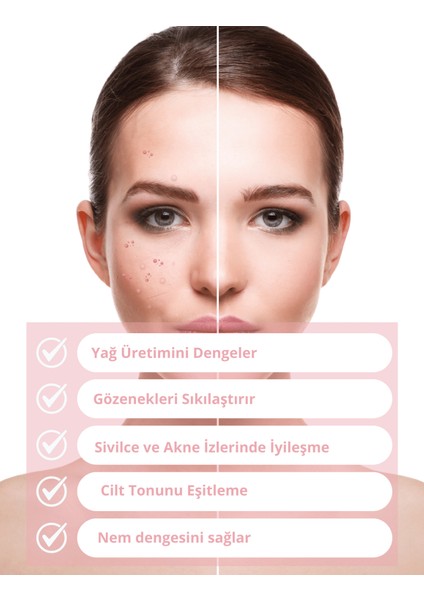 - Niacinamide – Moisturizing Cream (YAĞLI VE KARMA CİLT İÇİN) x 2