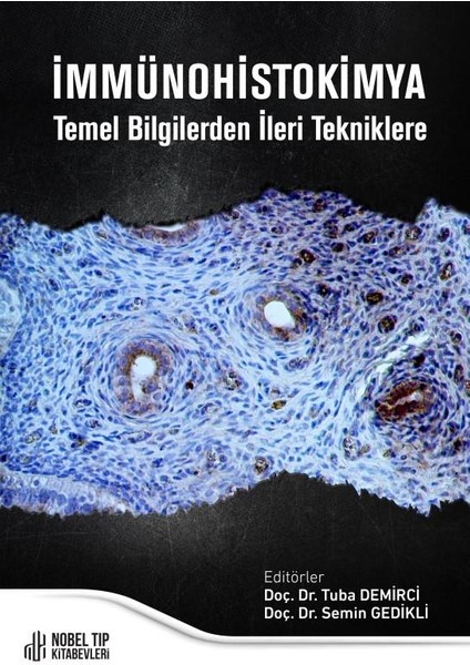 Immünohistokimya Temel Bilgilerden İleri Tekniklere