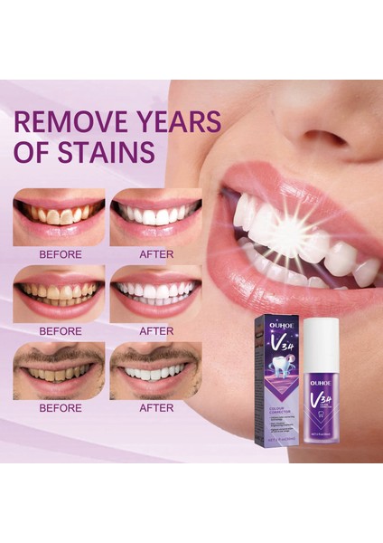 A 30ML Diş Beyazlatıcı Diş Macunu V34 Renk Diş Düzeltici Beyazlatıcı Dişler Mor Cilt Dostu Beyazlatıcı Diş Macunu (Yurt Dışından) fiyatları