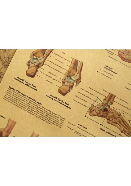 Ayak Ve Ayak Bileği Anatomisi Ve Yaralanmaları Posteri - Ayak Ve Ayak Bileği Eklemi Anatomi Şeması (Yurt Dışından)