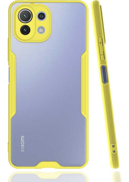 Storepgs Xiaomi Mi 11 Lite Kılıf Parfe Kapak-Sarı