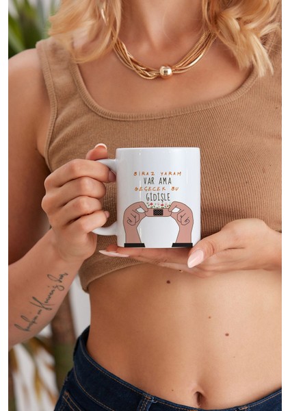 Biraz Yaram Var Ama Geçecek Baskılı Özel Baskı Tasarım Promosyon Porselen Kupa Mug Bardak Hediyelik