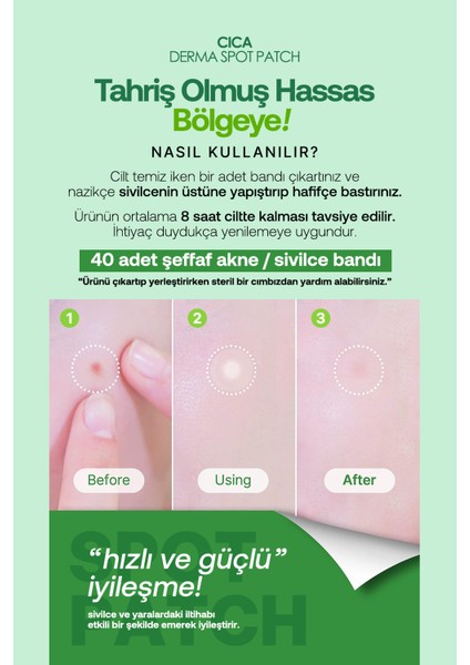 Cica Içeren Akne Bandı 40 Adet Lebelage Cica Derma Spot Patch 40 Pcs