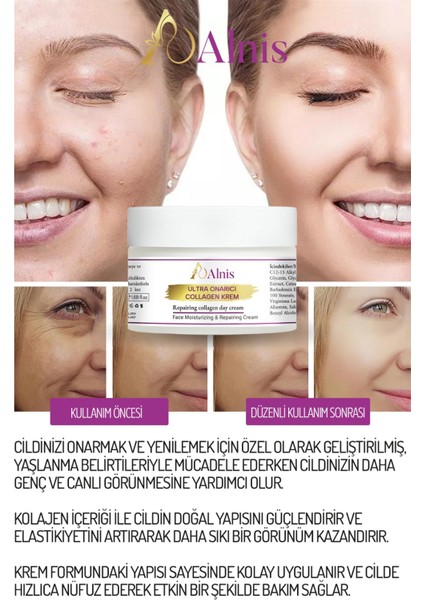 Yoğun Besleyici Yatıştırıcı ve Nemlendirici Ultra Onarıcı Collagen Krem