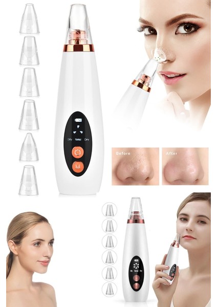 Vakumlu Temizleme Cihazı: Şarjlı, 6 Başlıklı Siyah Nokta Temizleme Aleti modelleri