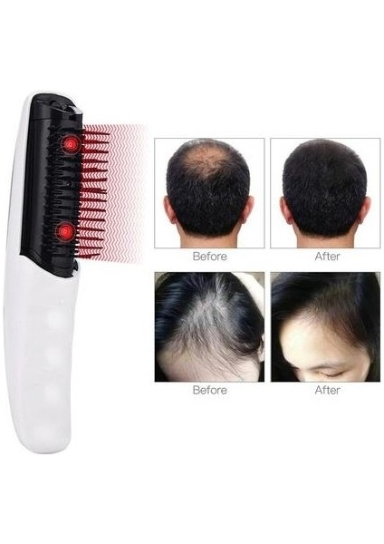 Elektrikli Kızılötesi Titreşim Saç Büyüme Tarak Kafa Sapı Teşvik Kafa Masaj Anti Terapi Saç Fırçası Saç Bakım Makinesi (Yurt Dışından) fırsatları