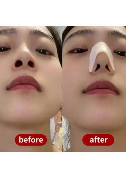 Ağrısızz Burun Şekillendirici Klips-Anında Burun Kaldırma & Inceltme,hipoalerjenik Güzellik Aracı