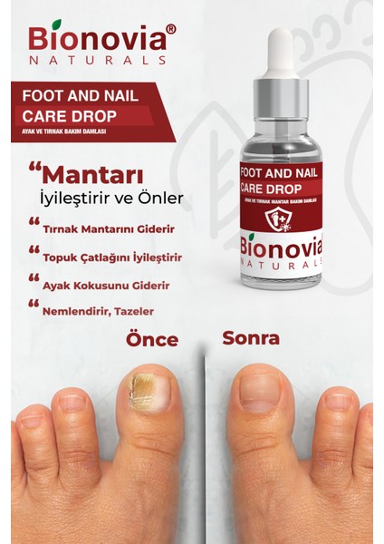 Ayak Tırnak Bakım Damlası Bitkisel İçerikli Lavanta, Çay Ağacı ve Gliserin 30 ml