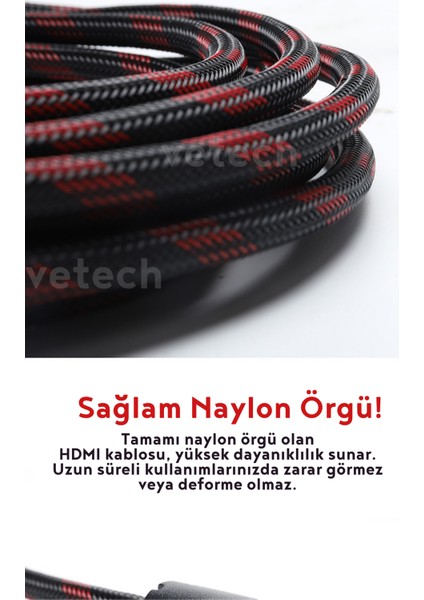 HDMI Kablo 1.5 Metre Örgü Sargılı Dayanıklı Full Hd Televizyon / Monitör / Tv HDMI Kablosu