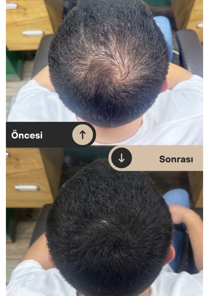 Hairboost Erkek Saç Kapatıcı Dolgunlaştırıcı Krem 50 ml 2 Adet (1 Adet Tarak Hediyeli) fırsatları