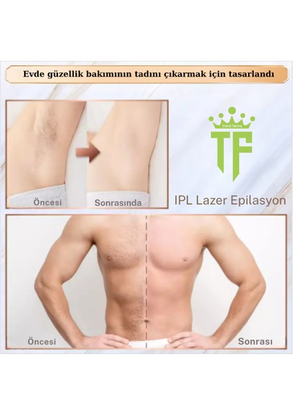 Trend Farma Hediyeli Soğuk Buz Ipl Lazer Epilasyon Cihazı - 999.999 Atım, Ağrısız Buz Lazer