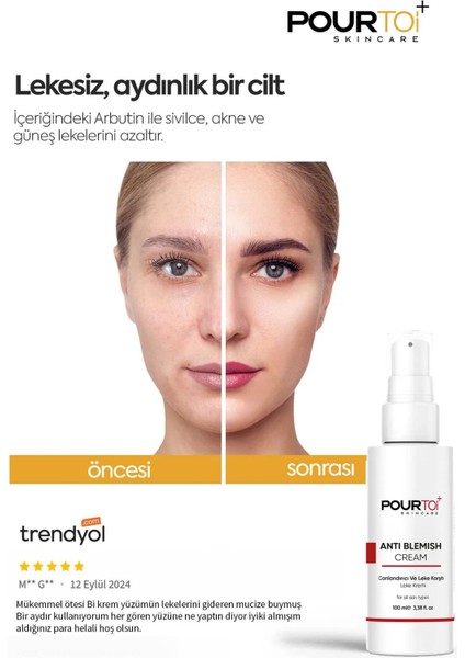 Anti Blemish Cream (CANLANDIRICI VE LEKE KARŞITI LEKE KREMİ) Arbutin, Retinol, Panthenol 100 ml