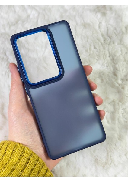 Buzlu Kamera Çıkıntılı Silikon Redmi Note 13 Pro 4g Kılıf