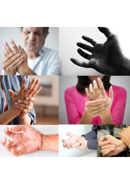 "robotik Rehabilitasyon Eldiveni: Sinir Felci ve Kas Güçsüzlüğü Tedavisi