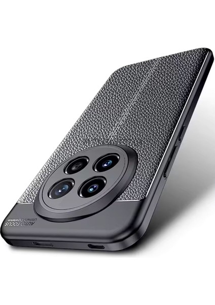 Xiaomi Redmi Note 14 Pro Kılıf Kamera Korumalı Deri Görünümlü Dikiş Desenli Koruyucu Niss Kapak
